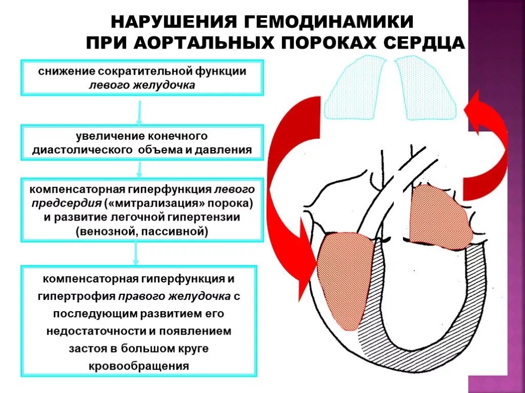 Недостаточность предсердия. Приобретенные пороки сердца изменения гемодинамики. Механизмы нарушения гемодинамики приобретенные пороки сердца. Стеноз аортального клапана. Механизм нарушения гемодинамики.. Аортальный стеноз схема.