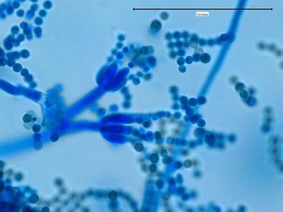 Пеницилл под микроскопом. Penicillium препарат микробиология. пенициллин микроскоп. пенициллиум методика исследования. пенициллин через микроскоп.