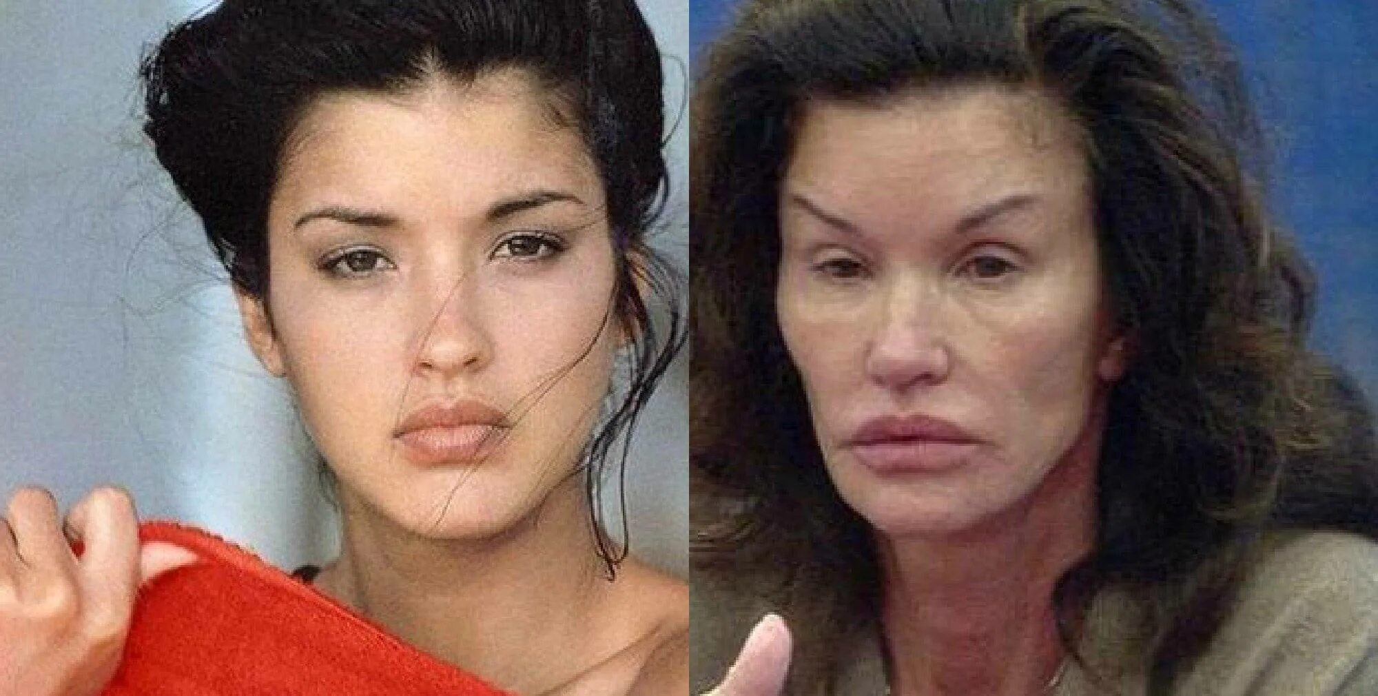 Виктория бекхэм до пластики. Комочки биша до и после операции. Иванка трамп пластические операции. Комочки биша до и после операции. Комки биша до и после.