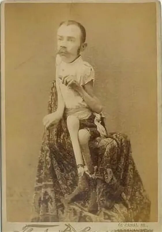 Дюма куртизанка. Бланш дюма трехногая женщина.