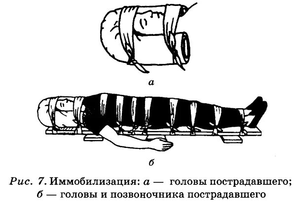 Травма первый мед. Иммобилизация при травме позвоночника. ПМП при травмах спины. ПМП при повреждении позвоночника. ПМП при травмах головы и позвоночника.