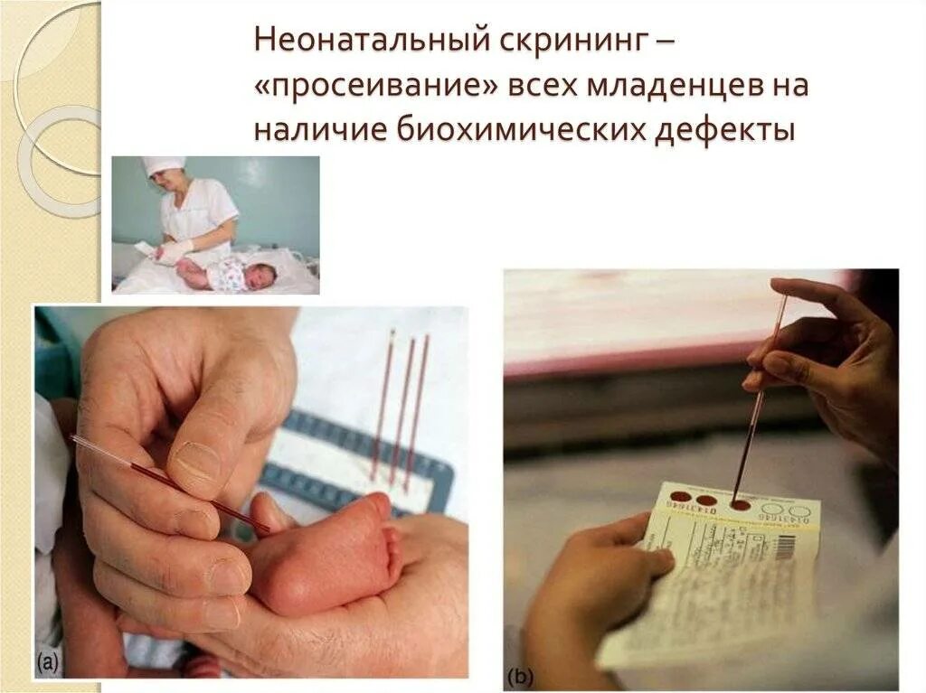 Заболевание выявляемое при неонатальном скрининге