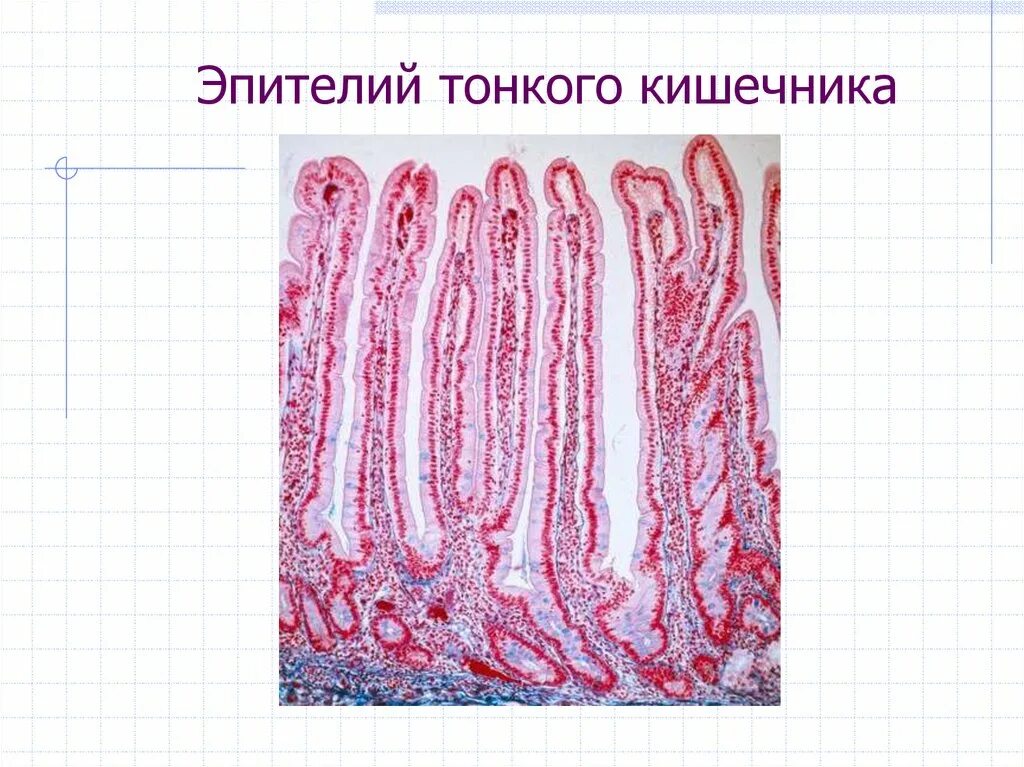 Клетки эпителия тонкой кишки