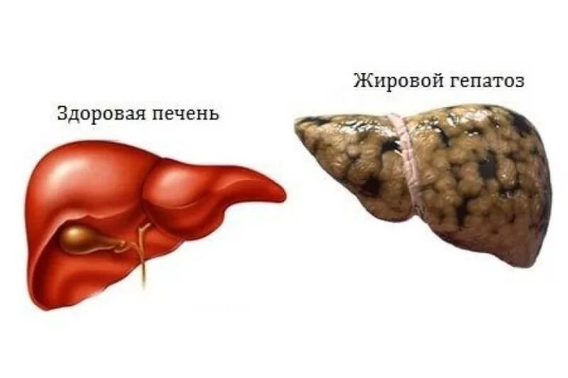 Вылечил печень форум