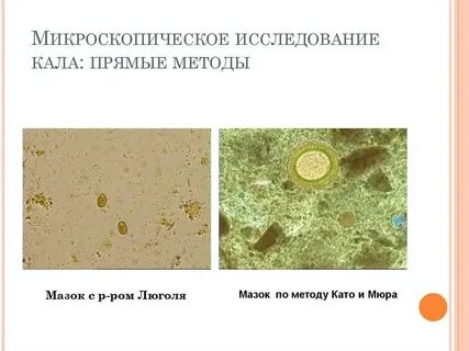 Исследование кала на простейшие методом обогащения