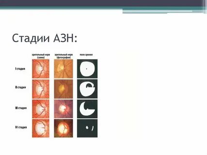 Мкб 10 зрительного нерва