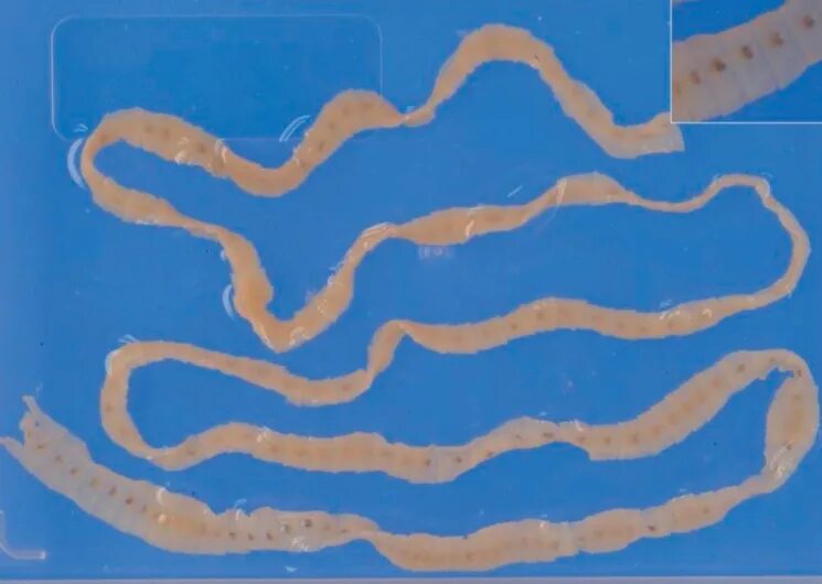 Личинки лентеца. Ленточные черви широкий лентец. Ленточный червь дифиллоботриоз.