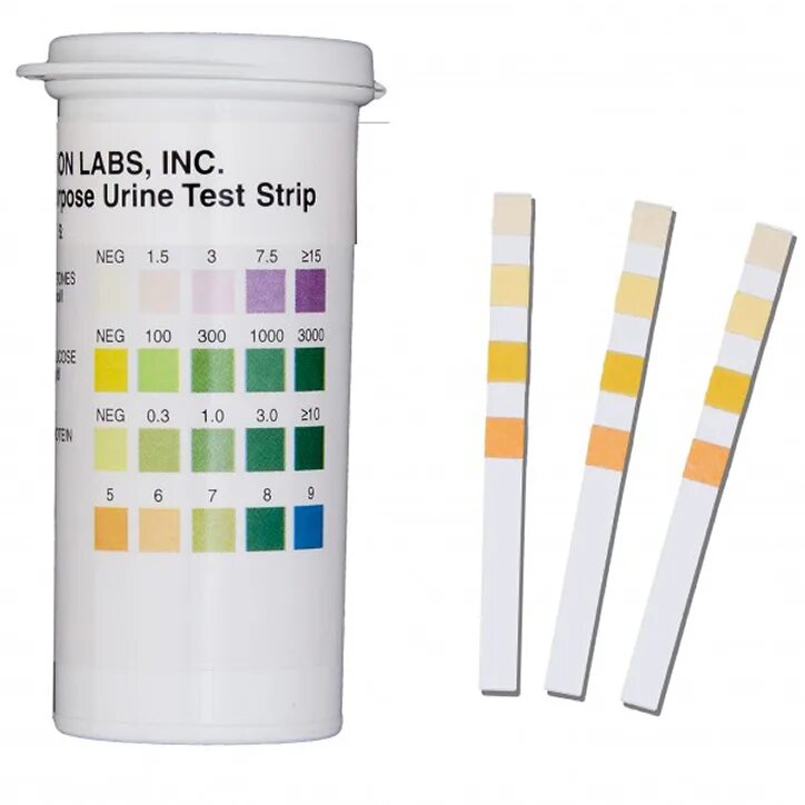 Рн мочи кота. Абаксис vetscan urine test strips тест полоска. urine test strip. тест полоски для ph мочи. urine dipstick test.
