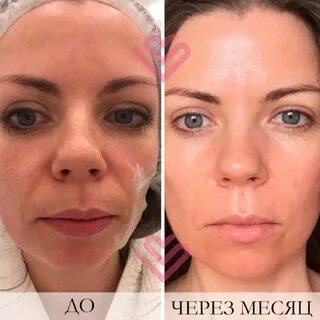 Процедура альтера отзывы
