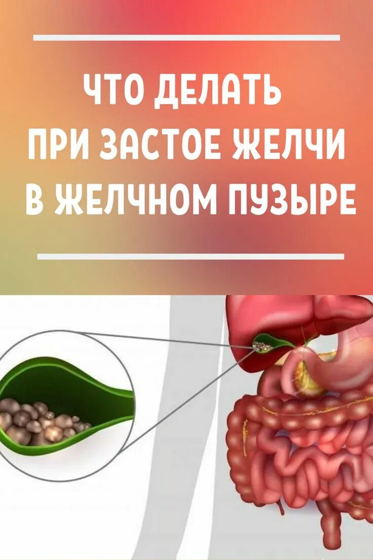 Восполениежелчногопузыря. Воспаление желчного пузыря. Воспаление делучногопузыря. Воспаление стенки желчного пузыря.