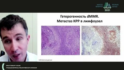Кал методом игх спб