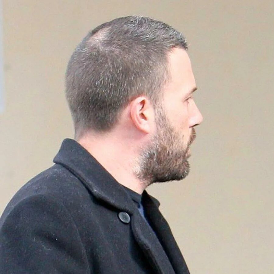 Small bald