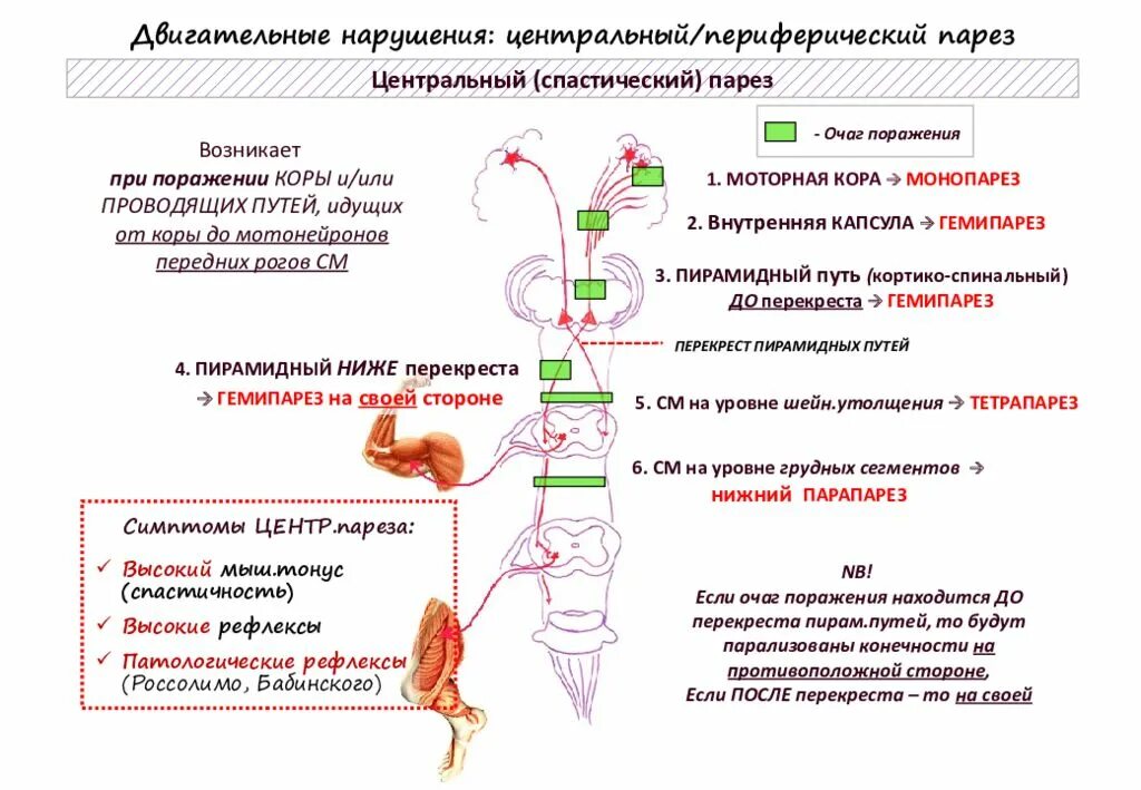 Парез латынь. Центральный Нижний парапарез синдром. Спастические параличи и парезы. Центральный и периферический парез. Спастический Нижний парапарез уровень поражения.