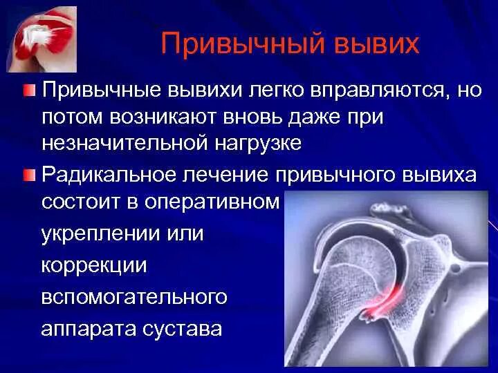 Травмы плечевого сустава травматология. Ранение плечевого сустава. Код по мкб растяжение связок коленного сустава