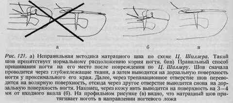 Количество зарасти