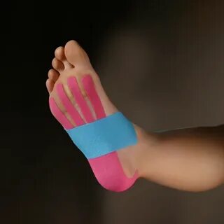 Тейпирование при фасциите