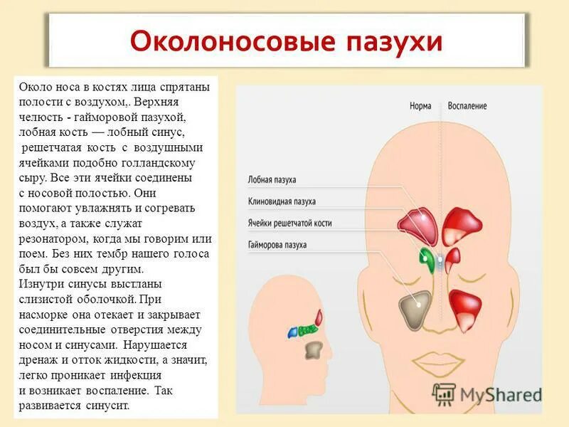 Околоносовые пазухи расположение функциональное значение ⚕ что такое ринофарингит (назофарингит)