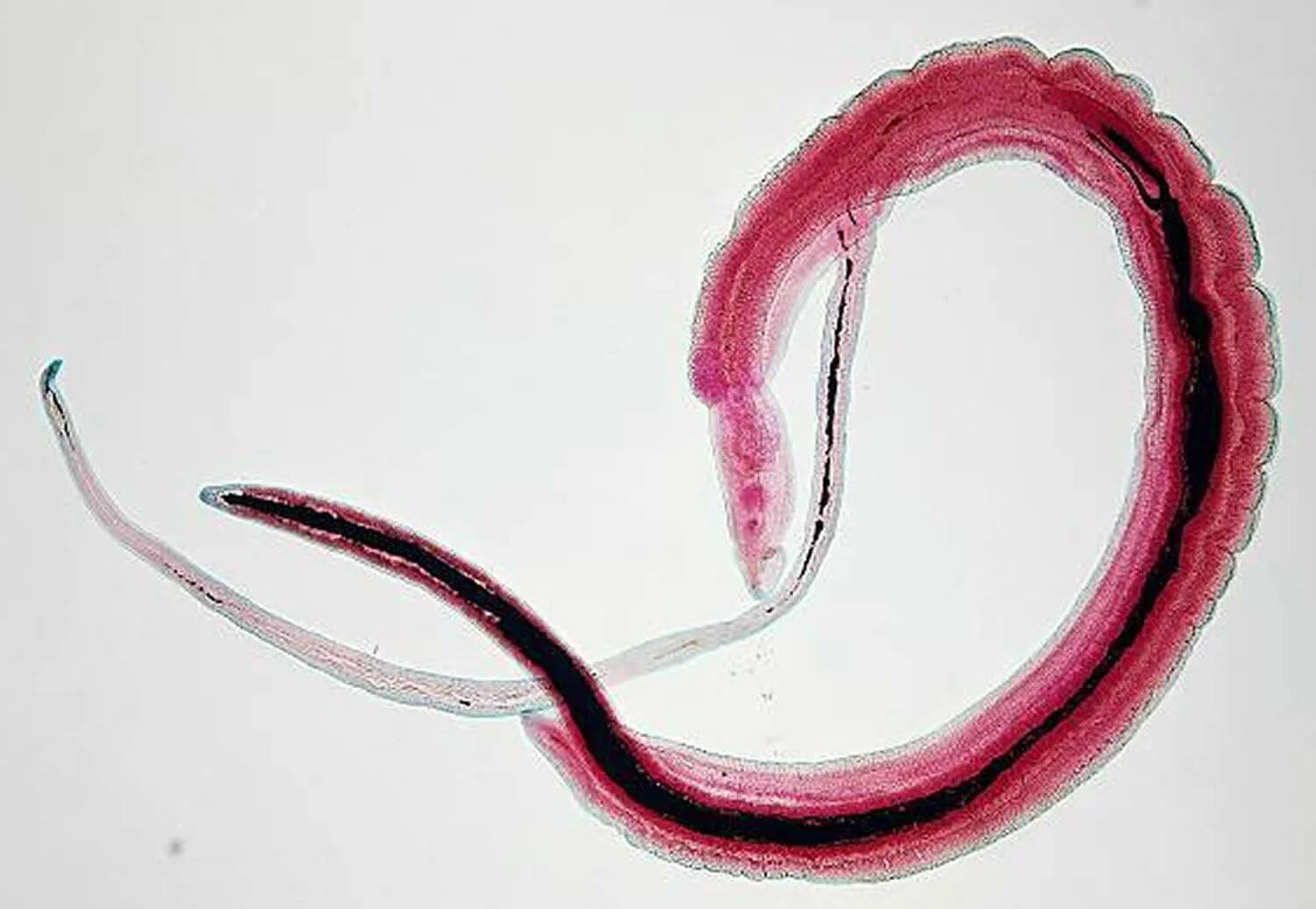 Червь геншин. Шистосома haematobium. Шистосома гематобиум. Кровяная двуустка (Schistosoma haematobium).