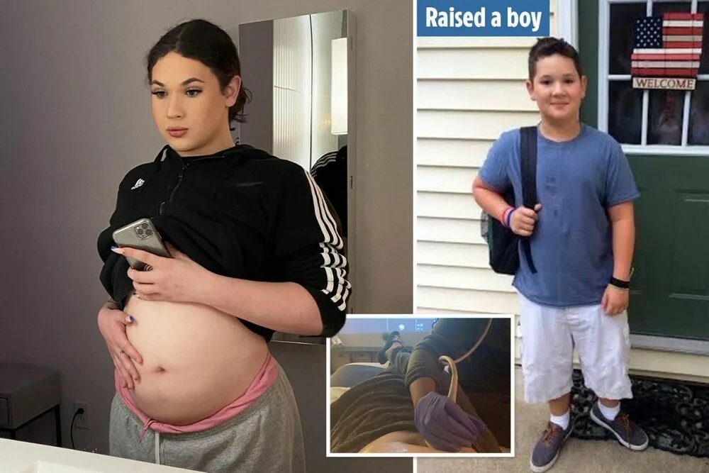 мужчина забеременел и родил ребенка