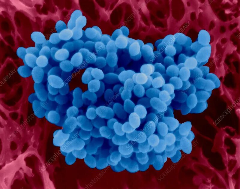 Enterococcus faecalis 10 в 6. Энтерококки faecalis. энтерококк фекальный микроскопия. стрептококки энтерококки. стрептококк faecalis.
