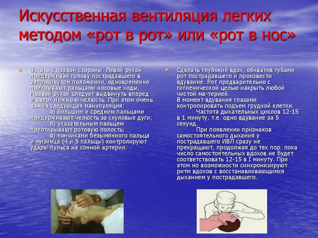 Искусственная вентиляция легких методом «рот в нос» проводится. Алгоритм проведения искусственной вентиляции легких. Искусственная вентиляция легких методом рот в рот. Способы искусственной вентиляции легких (ивл). Искусственная вентиляция легких методом донора.