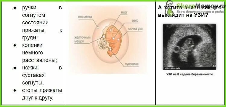 Как выглядит ребёнок в 8 недель на УЗИ. Размер плода на 8 неделе беременности. Как выглядит эмбрион в 8 недель на УЗИ. Расположение эмбриона на 8 неделе беременности. Состояния при 8 неделях