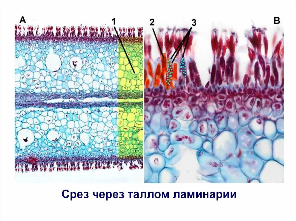 Деление клеток спорогенной ткани. Слоевища ламинарии микроскопия. Срез водоросли под микроскопом. Ламинария слоевища под микроскопом. Бурые водоросли под микроскопом.