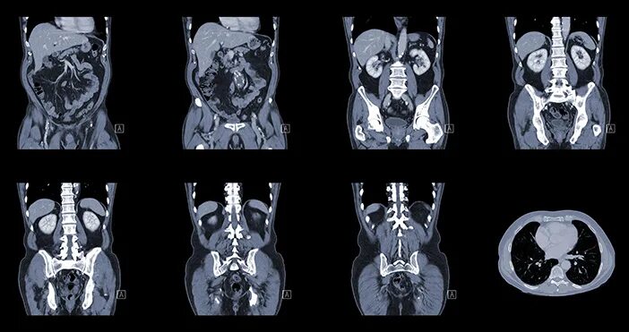 Кт анатомия ОБП. Мрт ОБП. Томограмма брюшной полости кт. Разница кт и кт с контрастом