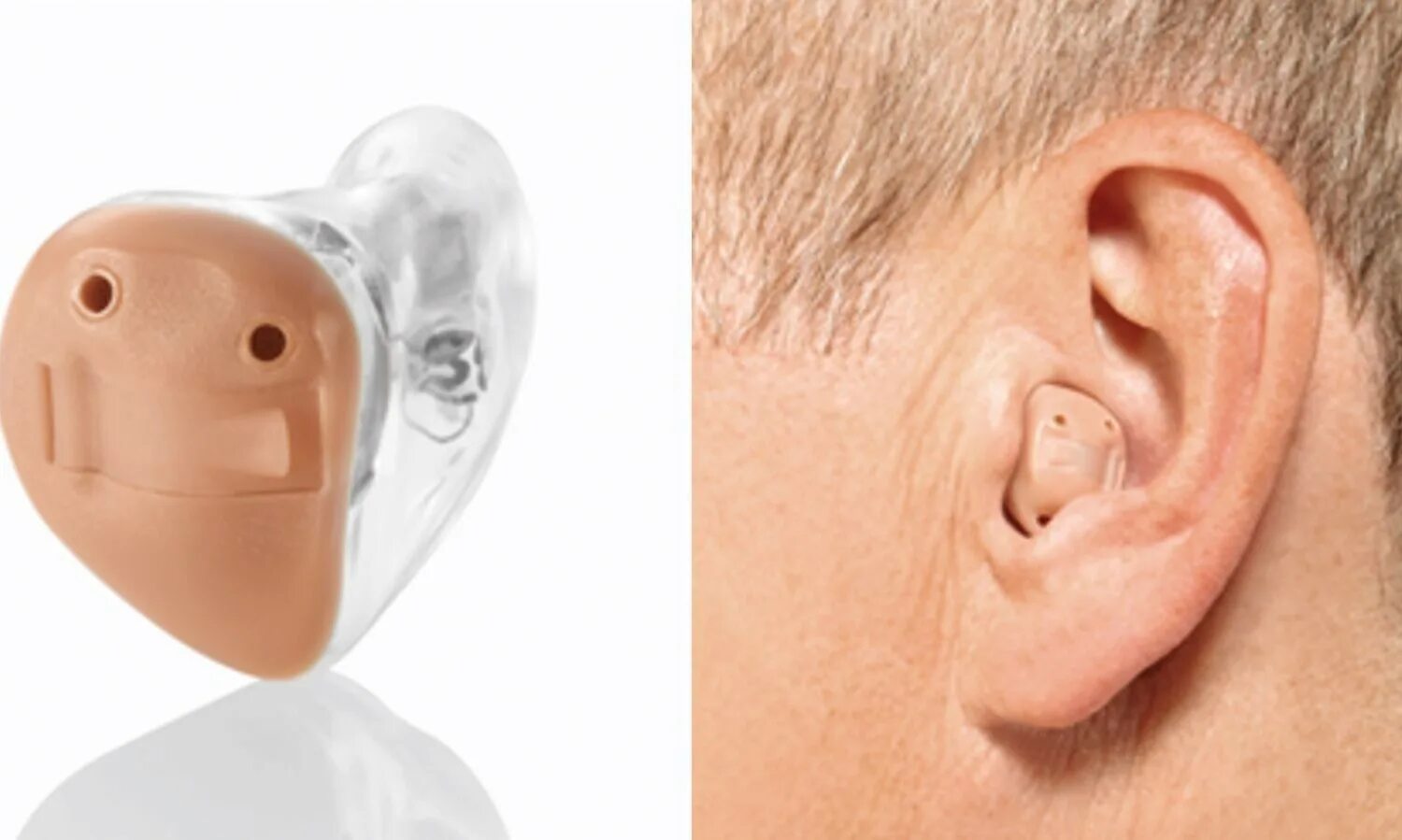 Слуховой аппарат ITC. Внутриканальные слуховые аппараты(ITC). Аппарат слуховой внутриушной конха. Внутриушной аппарат ITC.