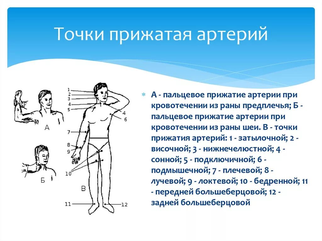 Пальцевое прижатие артерий. Точки пальцевого прижатия при кровотечении. Пальцевое прижатие артерий при кровотечениях. Пальцевая прижатие артерии.