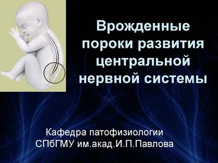 Врожденный порок нервной системы