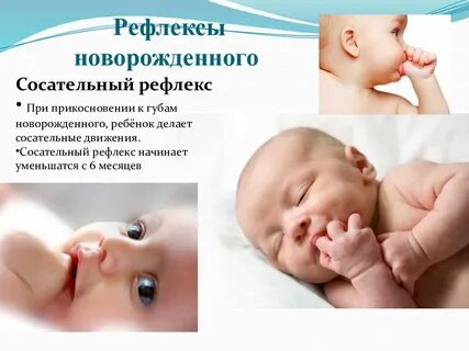 Рефлексы новорожденных педиатрия