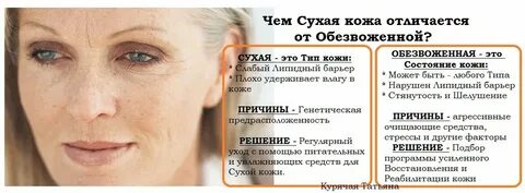 Сухая кожа причины лечение