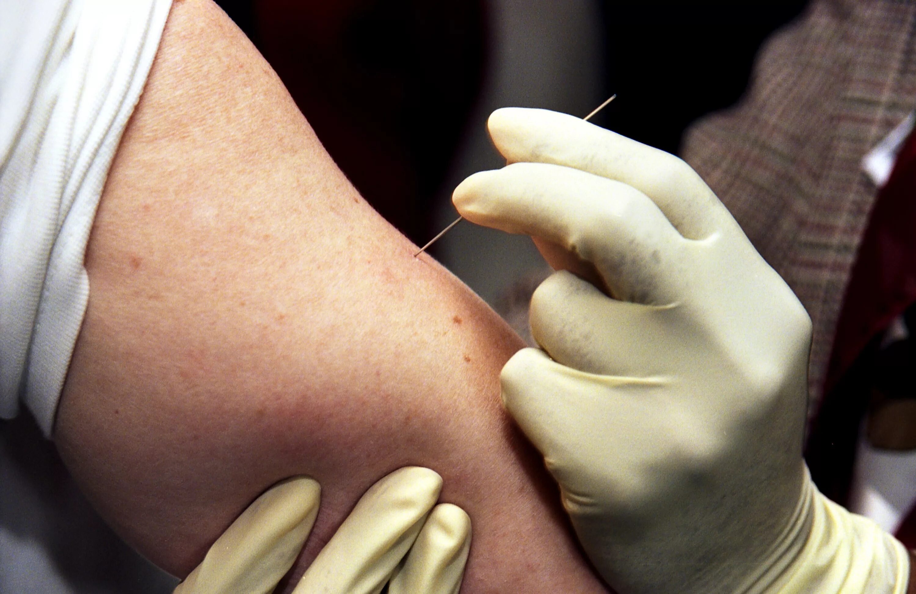 Вакцина от ветряной оспы схема вакцинации. Советские прививки от оспы. Вакцина против ветряной оспы название. Прививка против ветряной оспы детям схема. Вакцинация детей в ссср.