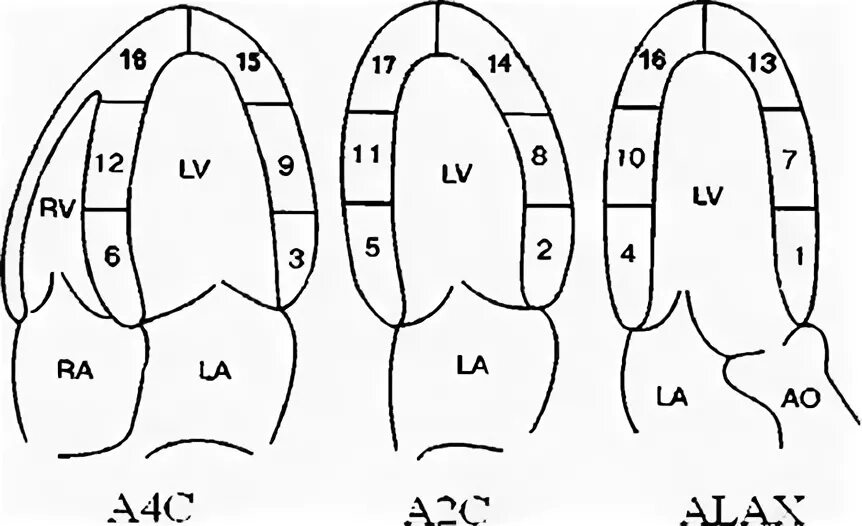 Сегментарное строение миокарда ЭХОКГ. Сегменты миокарда лж на УЗИ. Сегменты лж по Эхо кг. Сегменты миокарда левого желудочка схема.
