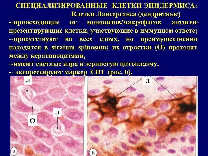 Клетки Лангерганса. Клетки Лангерганса в коже. Меланоциты клетки Меркеля клетки Лангерганса. Клетки Лангерганса гистология.