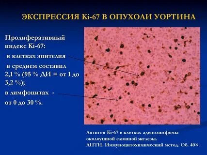 Пролиферативная активность клеток
