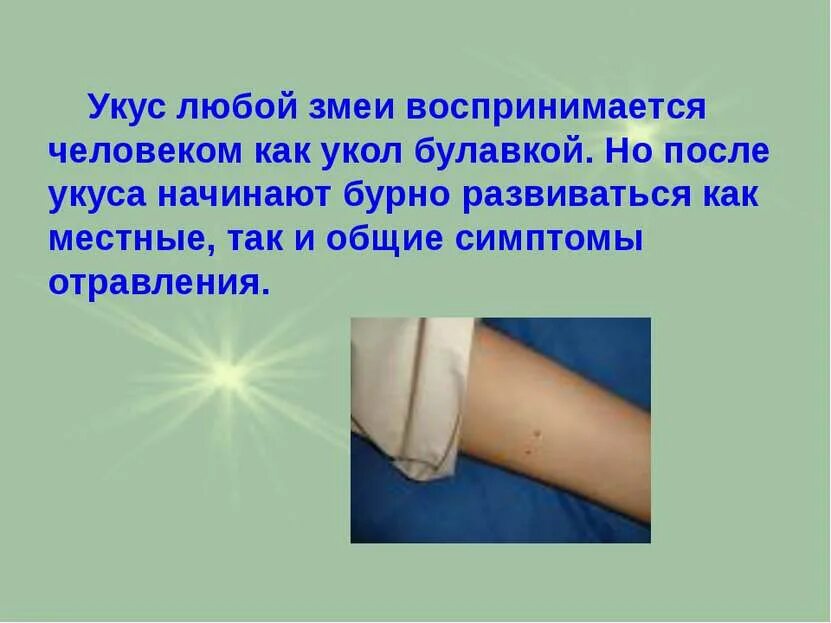 Умирают ли от укуса гадюки. Умирают ли от укуса гадюки. Умирают ли от укуса гадюки. Что делать если укусила гадюка первая помощь. Что делать при укусе гадюки первая помощь.