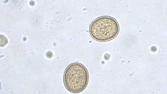 Онкосферы эхинококка. Яйца гельминтов эхинококк. Яйца эхинококка под микроскопом. Яйцо с онкосферой