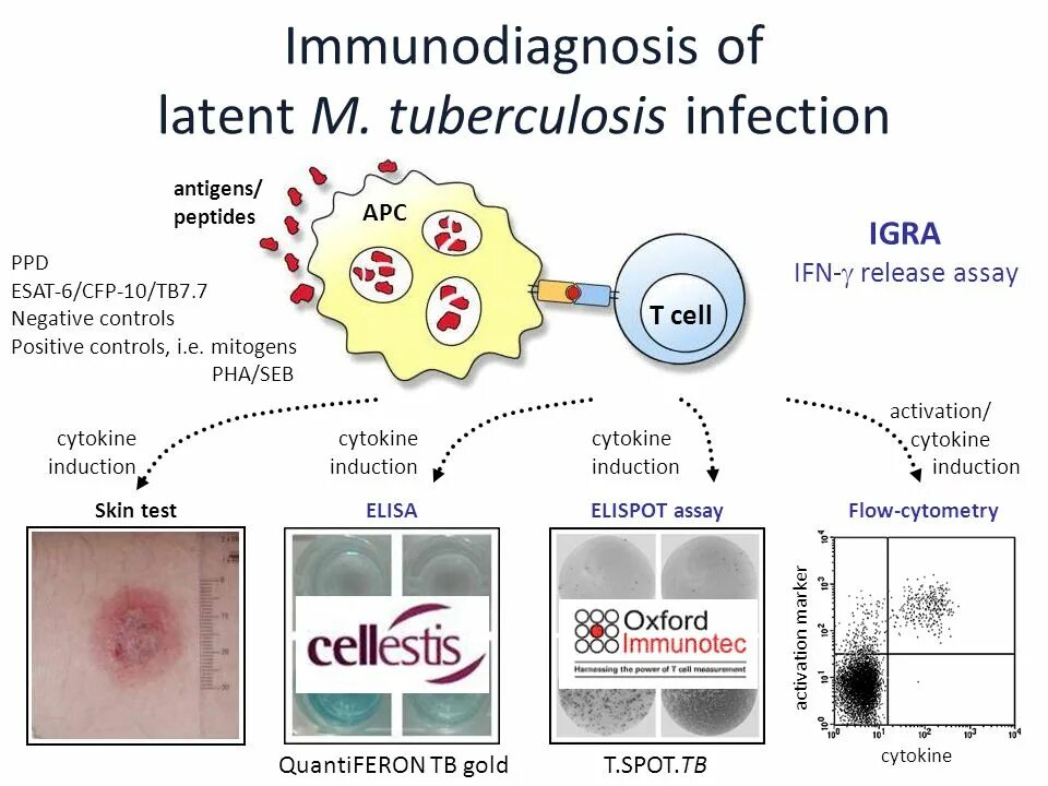 Латент. ELISPOT туберкулез. In vitro тесты на туберкулез. Туберкулеза методом t-spot.