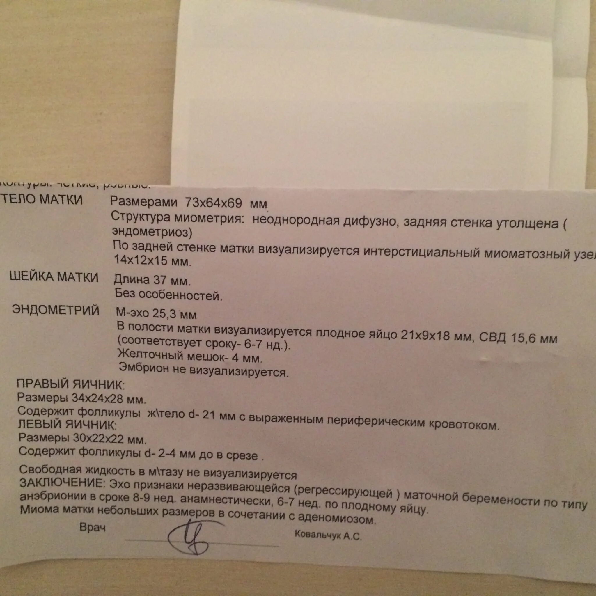 Зб замершая беременность. Замершая беременность 16 недель форум. Замершая беременность 16 недель форум. Узи 6 недель беременности заключение. Узи заключение замершей беременности.