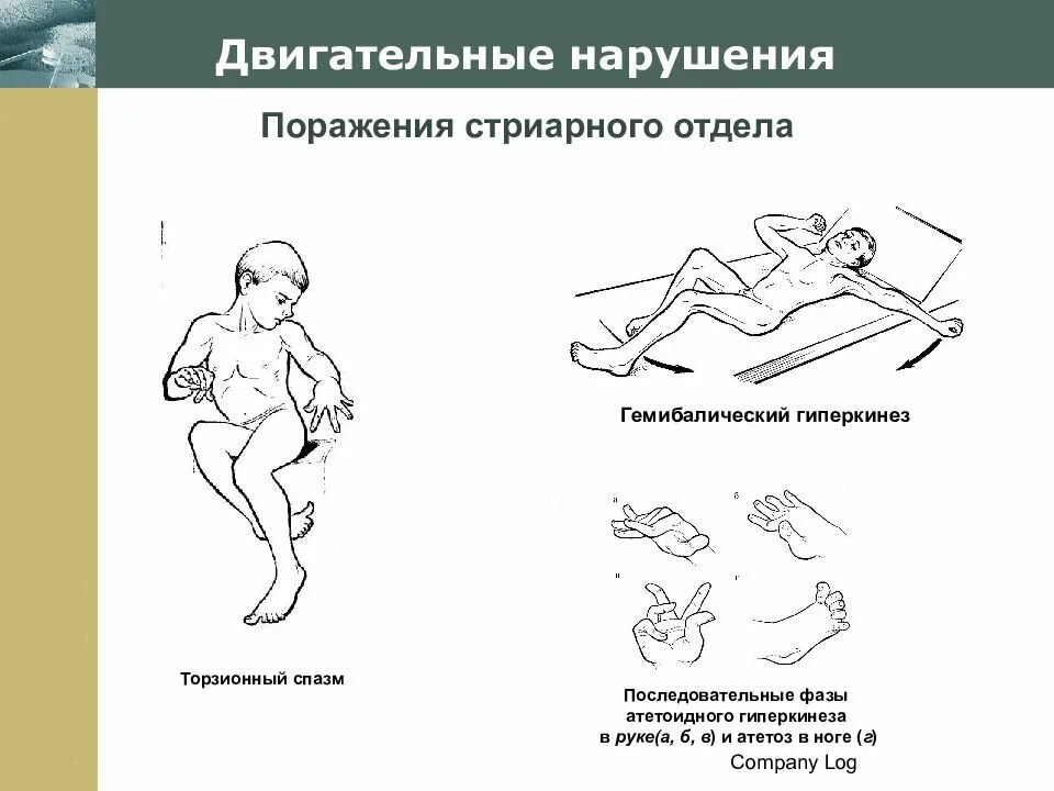Тактильно двигательное нарушение