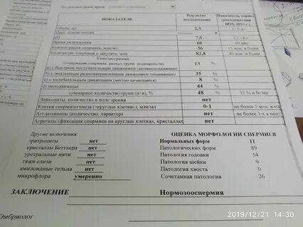 Спермограмма с морфологией по крюгеру