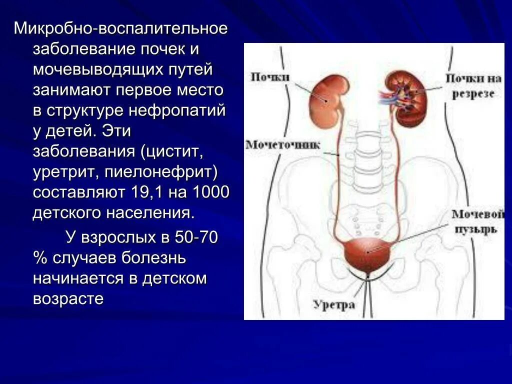 Заболевания мочевых путей. Болезни почек и мочевыводящих путей. Инфекции мочевыводящих путей пиелонефрит. Воспалительныезаболевпничмочевыводящихпутей. Заболевания выделительной системы.