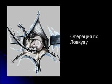 Герниология что это
