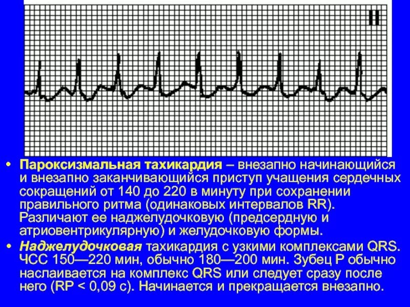 Чсс 140