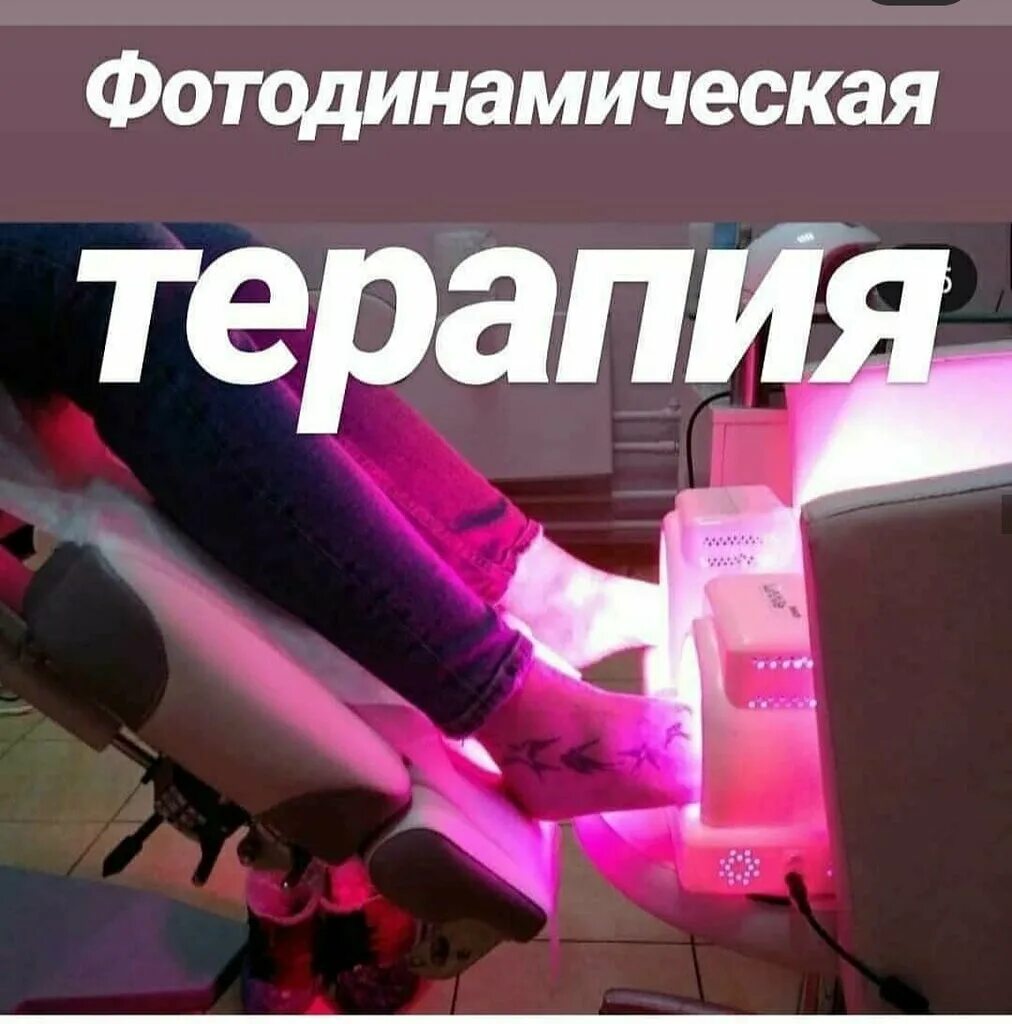 Фотодинамическая терапия грибка. Фотодинамическая терапия ногтей. Фотодинамическая терапия ногтей. Фотодинамическая терапия фото. Фотодинамическая терапия грибка ногтей.