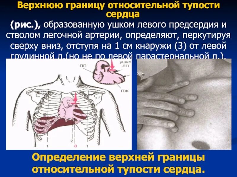 Относительная тупость