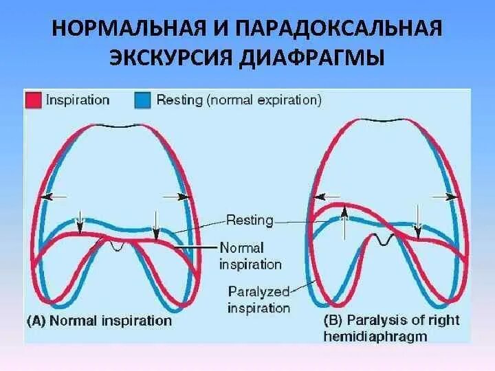 Подвижная диафрагма