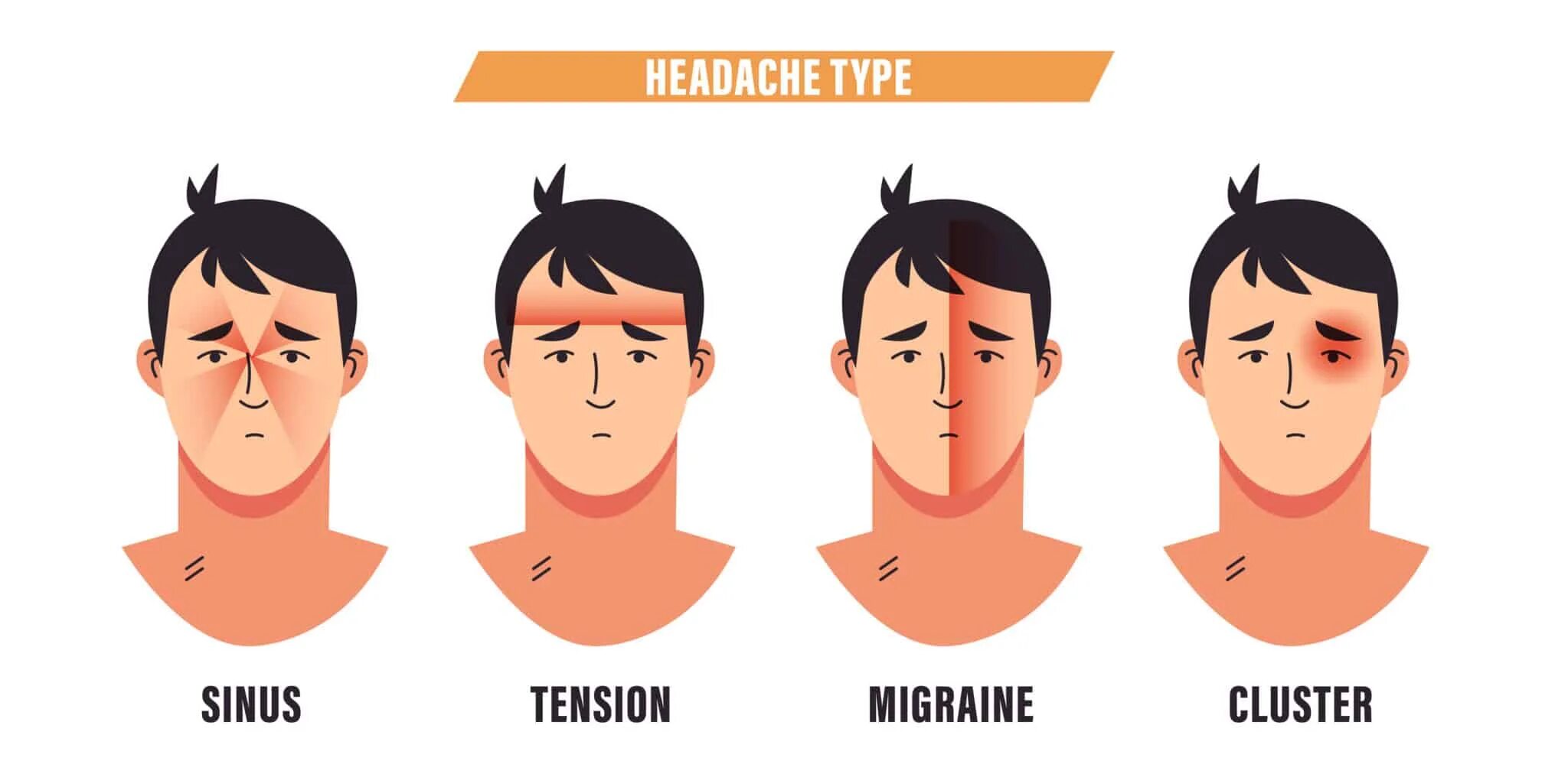Types of headache. SUNCT синдром. Tension Type headache. Бас головная боль. Что значит сильная голова
